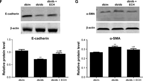 Figure 5 ECH inhibits renal tubular EMT in db/db mice by upregulating the expression of E-cadherin and downregulating the expression of α-SMA.