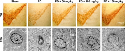 Figure 4 Effect of baicalin on TH-positive neurons in the brain of 6-OHDA-induced PD rat model.
