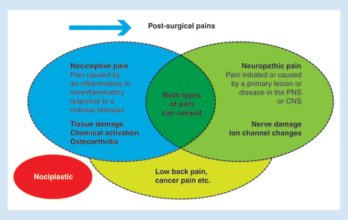 Figure 1. Key types of pain.CNS: Central nervous system; PNS: Peripheral nervous system.