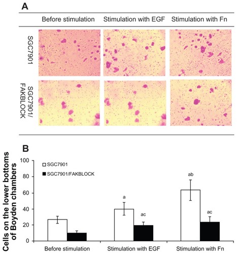 Figure 5 (A) Cells of SGC7901 and SGC7901/FAKBLOCK on the lower surfaces of filter membranes in Boyden chambers with stimulation of EGF or Fn. (B) Analysis of invasiveness of SGC7901 and SGC7901/FAKBLOCK with stimulation of EGF or Fn (χ̄ ± s, n = 5).