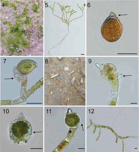 Figs 4–12. Photos of habitat and light microscopy of four Oedocladium strains. Figs 4–7. O. prescottii. Fig. 4. O. prescottii collected from damp soil. Fig. 5. Branched filaments from nature showing growth habit including rhizoids and young oogonium. Fig. 6. Oogonium and oospore, showing conical apices and caps. Fig. 7. Recurved oogonium branches with recurved oogonium containing immature spores and hypogynous antheridia. Figs 8–12. O. carolinianum. Fig. 8. O. carolinianum collected from wet soil by the roadside. Fig. 9. Showing the oogonium and dwarf males. Fig. 10. Showing the three layers of the oogonium, with middle layer angulate. Fig. 11. Showing the inferior split of the oogonium. Fig. 12. Branched filaments from cultured. Scale bars: 20 μm