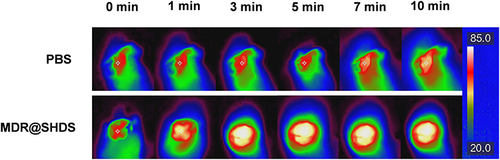 Figure 10 Thermal images of mice bearing tumor after injection of PBS or MDR@SHDS, followed by being exposed to 808 nm irradiation.