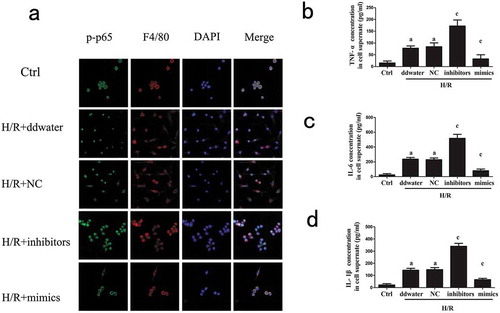 Figure 2. Effects of miR-125b on TRAF6 and NF-κB protein in cells.(a) The protein expression of TRAF6, p-IκBα, IκBα, p-p65, p65 and IL-1β in cells was detected. (b) The expression of TRAF6 in cells. F4/80 was used as the molecular marker of RAW 264.7 cells. The original magnification = 400×.