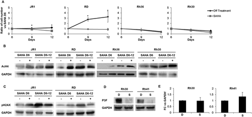 Figure 5. SAHA has prolonged effects after treatment withdrawal and decreases PAX3-FOXO1 protein levels in ARMS cells. (A) Total number of ERMS (JR1, RD and Rh36) and ARMS (Rh30) cells after withdrawal (Off treatment) or not (SAHA) of the 1 μM SAHA treatment at day 6 compared to vehicle-treated controls (0.01% DMSO). Each point represents the mean of at least 3 experiments. Bars represent standard deviation. Asterisks denote a statistically significant difference (p-value < 0.05). Western blot analysis of (B) acetylated histone H4 (AcH4) and (C) the DNA damage response protein phospho-H2AX at day 6 after treatment with 1 μM SAHA (SAHA D6 (+)) and day 12 either after withdrawal of the treatment at day 6 (SAHA D6-12 (-)) or not (SAHA D6-12 (+)) compared to vehicle DMSO control (SAHA D6 (-)) in the indicated cell lines. GAPDH serves as a loading control. (D) Western blot analysis of Pax3-FOXO1 (P3F) at 48 hours after treatment with 1 μM SAHA (S) or vehicle DMSO control (D) in the indicated cell lines; GAPDH serves as a loading control. (E) qRT-PCR analysis of PAX3-FOXO1 mRNA levels in Rh30 and Rh41 cells after 48 hours of treatment with 1 μM SAHA (S) or vehicle DMSO control (D), as indicated. Gene expression is shown relative to expression of the housekeeping gene GAPDH. Values are representative of at least 3 independent experiments, each done in triplicate. Bars represent standard deviation. Asterisks indicate p-value < 0.05.
