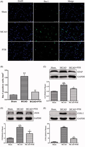 Figure 4. Effects of PTH on the number of Iba-1 positive cells and the protein expressions of GFAP, iNOS and COX-2 in MCAO rats (n = 3). (A) Representative Iba-1-staining brain sections in different groups (n = 3). (B) Quantitative analysis of Iba-1 positive cells in different groups (n = 3). (C-E) Representative western blot and quantitative analysis of GFAP (C), iNOS (D) and COX-2 (E) protein expression in different groups (n = 3). Data are presented as mean ± SEM. **p < 0.01 vs. Sham; #p < 0.05, ##p < 0.01 vs. MCAO.