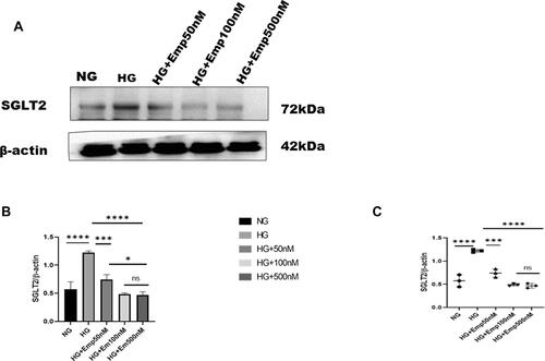 Figure 2 Effect of empagliflozin on SGLT2 expression in HK-2 cells. (A) Representative of Western blots illustrating SGLT2 and β-actin expression. HK-2 cells were planted in 5.5mM glucose and 25mM glucose medium with or without empagliflozin treatment for 72 h. Western blotting was performed using anti- SGLT2 and anti-β-actin antibodies. β-actin used as a loading control. (B) Quantification of Western blot data in HK-2 cells. (C) Dot plots scatter represented individual measurement. The data represent the mean ± SD of three independent experiments.*P < 0.05, ***P < 0.001, ****P < 0.0001 vs. high glucose.Abbreviation: ns, non-significant.