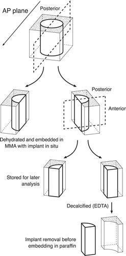 Figure 3. Preparation of bone-implant specimens. The cylindrical implant was cut vertically through the middle. By random choice, one-half remained undecalcified and was embedded in MMA. The other half was cut vertically through the middle of the implant. A posterior and anterior block were thus produced, each containing one-quarter of the implant. By random choice, one part was stored in formaldehyde and decalcified (EDTA). The implant was gently removed from the surrounding tissue, which was then embedded in paraffin. The remaining part was stored in 70% alcohol for a possible later analysis, which was not included in this work.