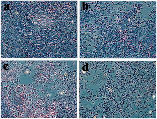 Figure 13. The images of H&E staining. (a: saline b: free Cur, c: DHPA-CDB/Cur, d: oHA-PBA@DHPA-CDB/Cur).