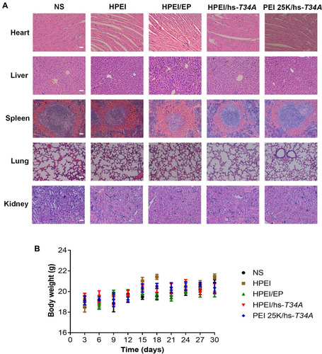 Figure 11 Safety and toxicity evaluation of HPEI/hs-T34A formulation.Notes: (A) The heart, liver, spleen, lung, and kidney in NS, HPEI alone (50 µg), HPEI/EP, HPEI/hs-T34A, or PEI 25K/hs-T34A group were collected and conducted with HE staining, respectively. Scale bar, 50 µm. (B). Body weight changes in NS, HPEI alone (50 µg), HPEI/EP, HPEI/hs-T34A, or PEI 25K/hs-T34A group, respectively.Abbreviations: HPEI, heparin–polyethyleneimine; PEI 25K, polyethyleneimine (molecular weight 25,000); HPEI/EP, heparin–polyethyleneimine/empty vector plasmid; NS, normal saline; hs, human survivin.