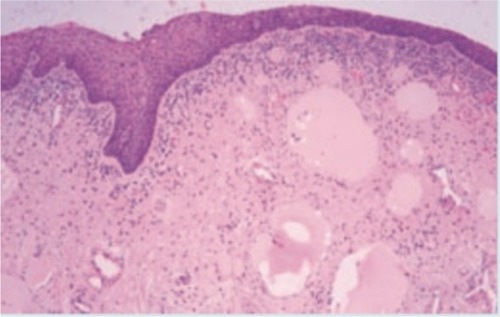 Figure 2 Normal urethral tissue (100× magnification).
