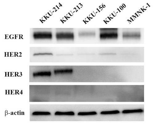 Figure 1 HER receptor family basal expression in cholangiocarcinoma cell lines and immortalized transform cholangiocyte.