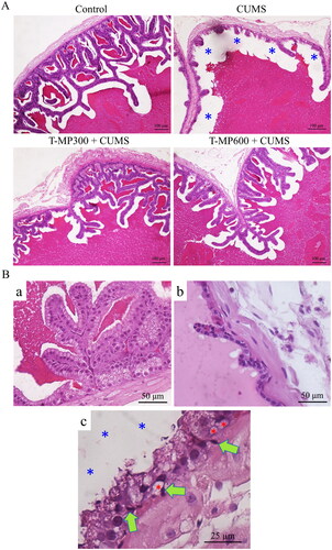 Figure 2. Representative microphotographs showing (A) histology of the seminal tissue and fluid strained by H&E, compared among control, CUMS and co-treated groups (T-MP 300 and 600 mg/kg BW). (Ba) normal seminal epithelium and histopathological features found in seminal vesicle of CUMS groups. (Bb) Decreasing of glandular epithelial cells. (Bc) Green arrows; pyknotic nuclei of basal cells, red asterisks; vacuolization within basal cells, blue asterisks; reduction of luminal seminal fluid.