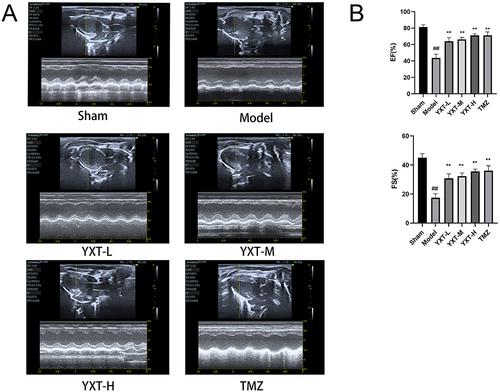 Figure 8 Cardiac ultrasound results of rats in each group. (A) Cardiac global function was quantitatively assessed from two-dimensional echocardiographic short axis images among the different groups; (B) Cardiac systolic function was determined by measuring ejection fraction (EF) and fraction shortening (FS).n=6. ##P<0.01 vs sham group; **P<0.01 vs model group; All values are depicted as mean ± SD.