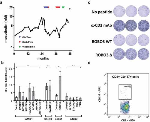 Figure 4. Description of biomarker levels and neoantigen identification in a single human patient (ID 9567). (a) Longitudinal serum mesothelin levels. Indicated by triangles are the time points for first-line chemotherapy (red -cisplatin and pemetrexed); second line (blue – carboplatin and pemetrexed) and third line (green – vinorelbine). (b) PBMC stimulated for 1 h with mutant peptide pool, then expanded in the presence of IL2 and CD3 for 14 days. T cell reactivity was assessed by ELISpot using the indicated mutant peptide exposed HLA expressing single antigen (SAL) lines. Controls show results for indicated HLA expressing SAL without peptides. Controls for HLA expressing SAL with wild-type peptides were performed for each mutant peptide of interest (Additional File 7 and data not shown). Difference between groups determined using non-parametric tests Kruskal-Wallis with Dunn’s multiple correction or Mann-Whitney as appropriate. *p < .05. SFU, spot forming units. (c) PBMC (200,000 cells per well) stimulated for 1 h with mutant ROBO3 peptide, then expanded in the presence of IL2 and CD3 for 14 days. T-cell reactivity was assessed by ELISpot assay. Negative control was T cells and B49:01SAL without peptide. Positive control was T cells plus αCD3 antibody. (d) CD137 cell surface expression measured using flow cytometry after stimulation of T cells with ROBO3 mutant peptide Wild-type controls are included in additional file 6