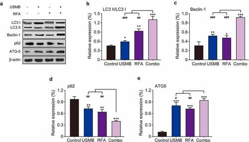 Figure 7. Effects of combination therapy of USMB and RFA on autophagy-related proteins in Panc02-bearing mice. (a) Representative western blot image and protein expression level of (b) LC3 II/LC3 I, (c) Beclin-1, (d) p62, and (e) ATG5 in pancreatic carcinoma tissues. *p < 0.05, **p < 0.01 and ***p < 0.001 vs. Control group; #p < 0.05, ##p < 0.01 and ###p < 0.001 vs. Combo group. Results were showed as means ± SD (n = 10)