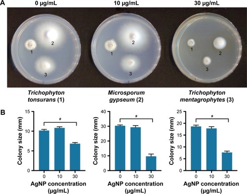 Figure 4 Anti-dermatophyte activity of silver nanoparticles. (A) Colonies of Trichophyton tonsurans (1), Microsporum gypseum (2) and Trichophyton mentagrophytes (3) on PDA and PDA supplemented with different concentrations of AgNP. (B) The bar charts represent the diameter of the colonies in the function of AgNP concentration. #Unpaired t-test p≤0.05.Abbreviations: AgNP, silver nanoparticle; PDA, potato dextrose agar.