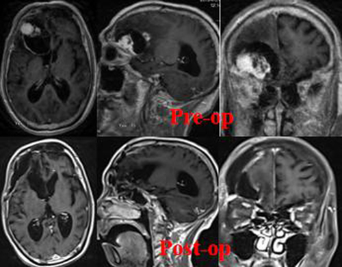 Figure 3 MRI imaging of case 2.