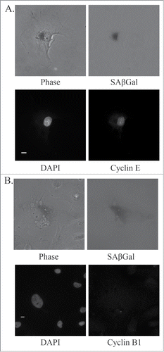 Figure 7. Markers of mitotic slippage in senescent U87MG cells after PKCι depletion. Representative immunofluorescence images of senescent U87MG cells 5 days after siRNA targeting PKCι (iota RNA A). (A) Top left, phase contrast; top right, SAβGal staining (grayscale); bottom left, DAPI; bottom right, Cyclin E. Scale bar = 10 μm. (B) Top left, phase contrast; top right, SAβGal staining (grayscale); bottom left, DAPI; bottom right, Cyclin B1. Scale bar = 10 μm.