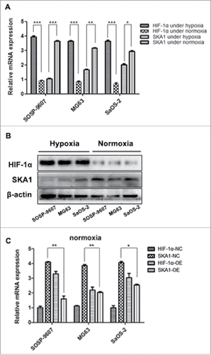 Figure 3. Analysis of HIF-1α and SKA1 expression in 3 human osteosarcoma cell lines. (A) mRNA expression of HIF-1α and SKA1 in SOSP-9607, MG63, and SaOS-2 cells under 1% O2 and 21% O2 for 96 hrs respectively as measured by qRT-PCR. (B) Protein expression of HIF-1α and SKA1 under hypoxic and normoxic conditions, as measured by western blot. (C) HIF-1α was overexpressed in 3 human osteosarcoma cell lines under normoxia, and the expression of HIF-1α and SKA1 were both measured by qRT-PCR. HIF-1α-NC and SKA1-NC represented HIF-1α and SKA1 expression under normoxia, respectively; HIF-1α-OE and SKA1-OE represented HIF-1α and SKA1 expression under normoxia in HIF-1α overexpressing cells, respectively. Both qRT-PCR and western blot analyses results were normalized with β-actin.*P < 0.05, **P < 0.01, ***P < 0.001.