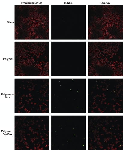 Figure 5 Microscopy Dox impact upon cellular proliferation and morphology was demonstrated via confocal microscopy. Macrophages cultured atop glass or polymer only substrates produced highly confluent growth. Macrophages cultured atop polymer–Dox and polymer–Dex–Dox nanofilm hybrids generated decrease cell confluency, enlarged, preapoptotic cells, as well as shrunken apoptotic cells due to Dox-induced cell death/apoptosis. TUNEL assays demonstrate the progression of cells grown on polymer–Dox and polymer–Dex–Dox nanofilm hybrids to apoptosis.Notes: Magnification: 40X, Leica inverted microscope Confocal Laser Scanning System.