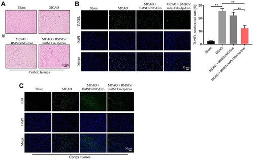 Figure 7 Exosomal miR-133a-3p derived from BMSCs attenuated MCAO-induced hippocampal neuronal degeneration. (A) H&E staining was performed to observe the histological changes in brain tissues of rats. (B) TUNEL staining was used to investigate the apoptosis in brain tissues of rats. (C) FJB staining was used to detect the hippocampal neuronal degeneration. **P< 0.01.