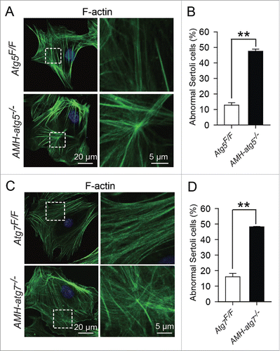 Figure 6. Disordered F-actin structures in autophagy-deficient Sertoli cells. (A and C) The structure of F-actin was disordered with severely accumulated foci in AMH-atg5−/−and AMH-atg7−/−Sertoli cells. Immunofluorescence analysis using phalloidin (green, labeled by FITC) was performed in Sertoli cells of Atg5Flox/Floxmice (upper panels) and AMH-atg5−/− mice (lower panels) (A). That of Atg7Flox/Floxmice (upper panels) and AMH-atg7−/− mice (lower panels) is shown in (C). Nuclei were stained with DAPI (blue). (B and D) The rate of abnormal Sertoli cells with severely accumulated F-actin foci was increased in AMH-atg5−/−and AMH-atg7−/−mice. In AMH-atg5−/− mice (black column), 47.49 ± 1.40% of Sertoli cells with severely accumulated F-actin foci, whereas 12.73 ± 1.59% of Atg5Flox/Flox mice (white column) had disordered structures (B). In AMH-atg7−/− mice (black column), 48.24 ± 0.22% of disordered F-actin structures, whereas 15.99 ± 2.22% of Atg7Flox/Flox mice (white column) did (D).