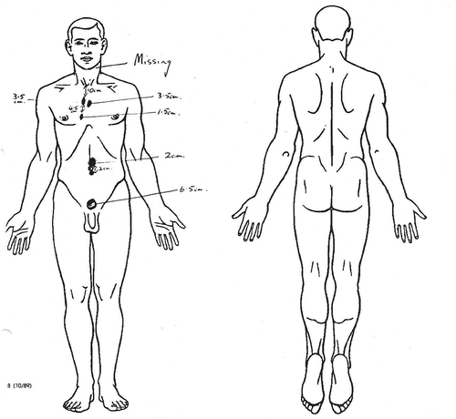 Figure 2. victim 2.