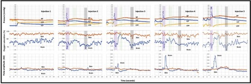 Figure 3 Responses to 5 sequential cranial vault injections of blood. Top panel: blood pressure (red), intracranial pressure (blue) and cerebral perfusion pressure (yellow). Each injection caused an immediate increase in the intracranial pressure (ICP) and drop in cerebral perfusion pressure (CPP). Blood pressure increased by 60 s and ICP fell, leading to a recovery in CPP. Middle panel: oxygen saturations and modified ratio of ratios (within figure Y axes) for brain (blue) and skin (orange) pulse oximeters. For the last 4 injections, the initial fall in CPP was also associated with a fall in brain oximeter oxygen levels (purple shading). The recovery in CPP was associated with a marked increase in brain oximeter oxygen levels (green shading). A second fall in brain oxygen levels (grey shading) occurred at ~150 s. Bottom panel: the brain oximeter pulse amplitude (blue) increased markedly, following the last 3 injections, but did not change with the skin pulse oximeter (orange). The oxygen saturation represents the average microvascular levels over the entire cardiac cycle. Pulse oximetry data represent the average for 7 sheep. The pressure data represent the average for 5 sheep. Each cranial vault injection commenced at time = 0.