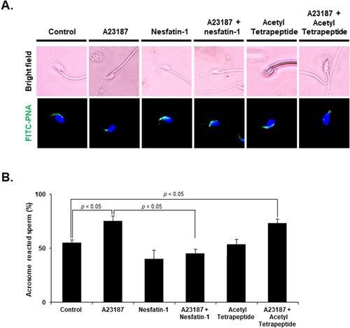 Figure 4. Effect of nesfatin-1 on the acrosome reaction in epididymal sperm. (A) Representative images of epididymal sperm stained with FITC-PNA to detect the acrosome after treatment with 10 μM A23187 and 100 nM nesfatin-1 for 24 h. Acrosome-intact sperm display bright green fluorescence over the acrosomal cap, while acrosome-reacted sperm exhibit no FITC-PNA staining. Sperm treated with A23187 showed weak labeling of the head, while those co-treated with A23187 and nesfatin-1 displayed strong labeling of the head, indicating that the acrosome reaction was inhibited. In contrast, sperm co-treated with acetyl tetrapeptide-1, which does not protect against the acrosome reaction, and A23187 showed weak labeling of the head. (B) Quantification of acrosome-reacted sperm after nesfatin-1 treatment. The percentage of sperm displaying the acrosome reaction increased after A23187, an inducer of the acrosome reaction. However, when sperm were co-treated with A23187 and nesfatin-1, the percentage of sperm displaying the acrosome reaction was lower than treatment with A23187 alone. In contrast, co-treatment with acetyl tetrapeptide-1, which does not protect against the acrosome reaction, increased in acrosome reactions, similar to the control group. All data are represented as mean ± SEM (n = 5). Differences between values were considered statistically significant when p < 0.05.