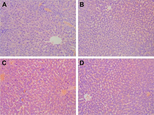 Figure 10 Histological changes after honokiol nanoparticle treatment in rats.Notes: (A) Control rats; (B) free honokiol-treated rats (50 mg/kg); (C) and (D) honokiol nanoparticle-treated rats 50 and 100 mg/kg. Scale bars =40 μm.