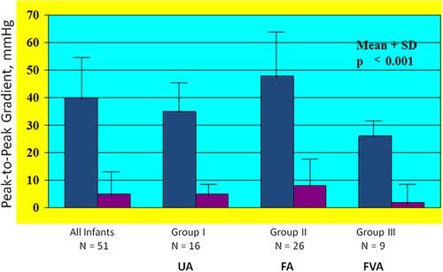 Figure 5 Bar graph showing reduction (p < 0.001) of peak-to-peak systolic pressure gradients (in mmHg) across the aortic coarctation after balloon angioplasty. The fall in the gradients was seen for the entire group (left panel) and for all the three subgroups, namely trans-umbilical arterial (UA), trans-femoral arterial (FA) and trans-femoral venous anterograde (FVA). Mean + standard deviation (SD) are shown. N represents number of subjects in each group. Modified from Rao PS, Jureidini SB, Balfour IC, Singh GK, Chen SC. Severe aortic coarctation in infants less than 3 months: Successful palliation by balloon angioplasty. J Intervent Cardiol. 2003;15(6):202–208.Citation34