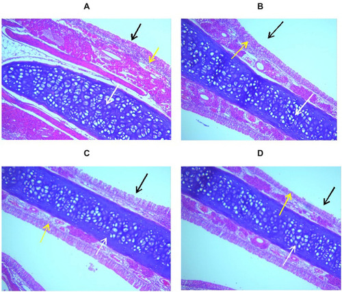 Figure 6 Histopathological images of the nasal mucosal tissue stained with H&E (x200). (A) Control untreated group, (B) plain in situ gel group, (C) raw FLB loaded in situ gel group, and (D) optimized FLB-NLC in situ gel.