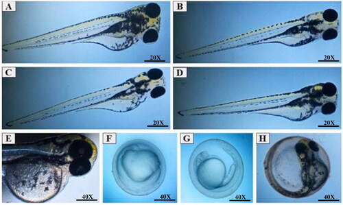 Figure 7. Zebrafish embryo micrographs at 24, 48, 72 and 96 hpf. A) normal embryo exposed to system water at 96 hpf; B) embryos treated with 100 µg/L DMSO 1% at 96 hpf, without developmental changes; C) embryo treated with 1.5 µg/mL of HESBg at 72 hpf, without developmental changes; D) embryo treated with 1.5 µg/mL of HELBg at 72 hpf, without developmental changes; E) embryo treated with 1.5 µg/mL of HELBg at 96 hpf, without developmental changes; F) embryo treated with 1.5 µg/mL of HELBg at 24 hpf, with developmental delay; G) embryo treated with 1.5 µg/mL of HELBg at 48 hpf, with developmental delay; H) embryo treated with 1.5 µg/mL of HESBg at 96 hpf, killed for not hatching.