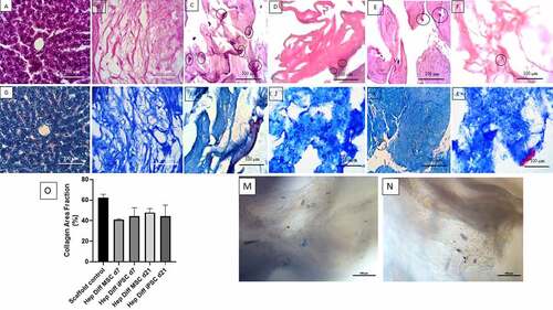 Figure 1. Histological features of hepatocyte differentiation in decellularized liver scaffold (Mag. 400x). A: HE-stained Liver control, B: HE-stained decellularized liver scaffold, C: HE-stained hepatocyte-differentiated MSC d7 in decellularized liver scaffold, D: HE-stained hepatocyte- differentiated iPSC d7 in decellularized liver scaffold, E: HE-stained hepatocyte-differentiated MSC d21 in decellularized liver scaffold, F: HE-stained hepatocyte-differentiated iPSC d21 in decellularized liver scaffold, G: Masson trichrome-stained liver control, H: Masson trichrome-stained decellularized liver scaffold, I: Masson trichrome-stained hepatocyte-differentiated MSC d7 in decellularized liver scaffold, J: Masson trichrome-stained hepatocyte-differentiated iPSC d7 in decellularized liver scaffold, K: Masson trichrome-stained hepatocyte-differentiated MSC d21 in decellularized liver scaffold, L: Masson trichrome-stained hepatocyte-differentiated iPSC d21 in decellularized liver scaffold cells suspected of being MSCs were clearly observed (marked with circles), M: Brightfield image from inverted microscope of hepatocyte-differentiated iPSC d7 in decellularized liver scaffold, N: Brightfield image from inverted microscope of hepatocyte-differentiated iPSC d7 in decellularized liver scaffold. Circles marked cell adherence to scaffold. O. Quantification collagen area using Image J measurement from hepatocyte differentiated MSCs (n = 3) or iPSCs (n = 3) in decellularized liver scaffold (%).
