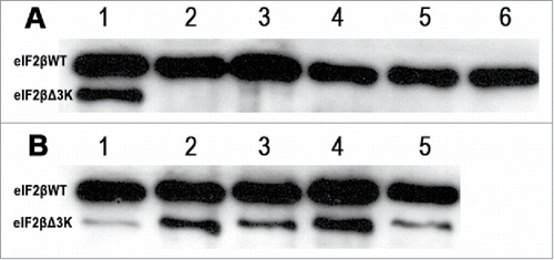 Figure 2. Western blot analysis of eIF2βWT and eIF2βΔ3K after induction with tetracycline (1 μg/mL). A shows eIF2β either endogenous and expressed from pJL::eIF2βWT, line 1: expression of eIF2βΔ3K after 24 hours of induction used as control, lines 2 to 6 expression of eIF2βWT induced after 1, 24, 48, 72 and 96 hours, respectively. B shows eIF2βΔ3K expression induced after 1, 24, 48, 72 and 96 hours, in lines 1 to 5, respectively.