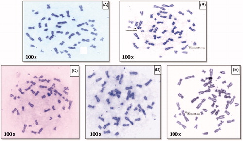 Figure 9. Chromosomal aberration at different concentration: (A) control, (B) positive control, (C) 2 μg/ml of AgNPs, (D) 50 μg/ml of AgNPs, and (E) 200 μg/ml of AgNPs (magnification 0).