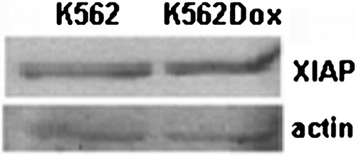 Figure 1. XIAP expression levels in K562 and K562Dox cells. Both cell lines express similar levels of XIAP protein.