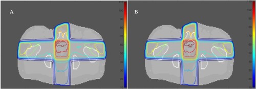 Figure 6. The entire treatment plan (a) with and (b) without 40 mg/ml nanogold mixed with prostate tissue using 6 MV with FF.