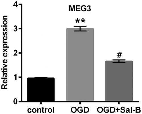 Figure 4. OGD-induced MEG3 overexpression was repressed by Sal-B. Relative expression of MEG3 was detected with qRT-PCR method in H9c2 cells stimulated with or without OGD for 2 h and/or pre-incubated with Sal-B (10 μM) for 2 h. **p < .01 compared with the normoxia control. #p < .05 compared with the OGD-treated group. MEG3: maternally expressed gene 3; OGD: oxygen and glucose deprivation; Sal-B: salvianolic acid B; qRT-PCR: quantitative reverse transcription PCR.