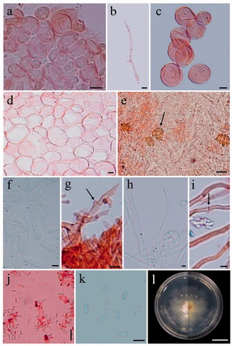 Figure 4. Microscopic features of Phallus chiangmaiensis. (a,b) Cap cells and hyphae. (c) Cells of indusium. (d) Cells of pseudostipe. (e) Crystals in volva hyphae (arrowed). (f,g) Volva hyphae with clamp connections (arrowed). (h,i) Rhizomorph hyphae with clamp connections (arrowed). (j) Basidia with sterigmata and basidiospores. (k) Basidiospores. (l) Colony on PDA (surface and reverse plate). Scale bars: a, c–e = 20 µm, b, f–j = 10 µm, g, k = 5 µm, l = 10 mm.