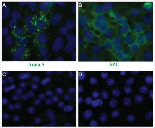 Figure 4. Differentiation potential of SUCECs into type (I)and II pneumocytes: SUCECs were cultured on collagen 1-coated culture dishes in epithelial differentiation medium for 6 d After the incubation, the cells were examined for the expression of (A) Aqua 5 and (B) SPC, specific markers for type I and II pneumocytes, respectively by IFA. Expression of Aqua 5 and SPC was not observed on SUCECs cultured in DMEM (C and D). Cell nuclei were stained by DAPI.