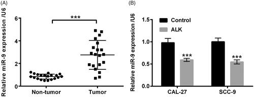 Figure 4. miR-9 expression was enhanced in OSCC tissues but repressed by ALK in OSCC cells. (A) Expression level of miR-9 determined by RT-qPCR was probed in 20 OSCC tissues and the para-carcinoma tissues. (B) Expression level of miR-9 assessed by RT-qPCR was explored in OSCC cell lines after ALK stimulation. ***p<.001.