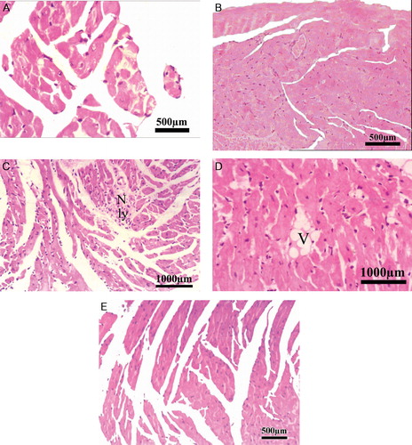 Figure 2. Photomicrograph of mouse heart from (A) control mice showing normal morphology (magnification: ×40) (scale bar = 500 µm); (B) heart section of S. kali-treated mice showing normal morphology (magnification: ×20) (scale bar = 500 µm). (C) Heart section of ADR-treated mice showing necrosis (N) and lymphocytic infiltration (Ly) (magnification: ×20) (scale bar = 1000 µm); (D) Heart section of ADR-treated mice showing perinuclear vacuolization (V) (magnification: ×20) (scale bar = 1000 µm); (E) Heart section of S. kali + ADR treated mice showing no significant necrosis of muscle fiber with mild edema (magnification: ×20) (scale bar = 1000 µm).