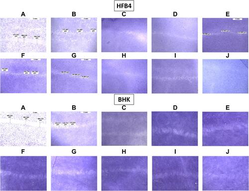 Figure 6 Micrographs of the stained healed monolayer of HFB4 and BHK cells. (A) Control at 0 h, (B) control after 48 h, (C) Vit E, (D) Vit C, (E) collagen, (F) plain NE lacking Vit E, (G) plain NE, (H) Vit C-loaded NE, (I) collagen-loaded NE, and (J) A mixture of collagen- and Vit C-loaded NEs.