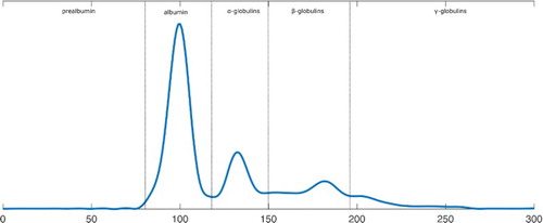 Figure 2. Plasma protein electrophoresis of parrot P10, 8 weeks before infection.