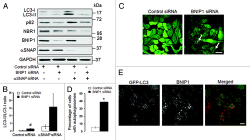 Figure 10. Enhanced autophagy in αSNAP-depleted epithelial cells does not depend on BNIP1. (A and B) SK-CO15 cells were subjected to sequential transfections with one of the following siRNA pairs: control-control, control-BNIP1, control-αSNAP and BNIP1-αSNAP. Expression of targeted proteins and autophagic markers was determined by immunoblotting at 48 h after the second transfection. #p < 0.01 compared with control siRNA-transfected cells. (C and D) HeLa-GFP-LC3 cells were transfected with either control or BNIP1-specific siRNAs and accumulation of autophagosomes was monitored by fluorescence spectroscopy. Scale bar, 20 µm; *p < 0.001 compared with control siRNA-transfected cells. (E) HeLa-GFP-LC3 cells subjected to αSNAP depletion were immunolabeled for BNIP1 (red) at 72 h post-transfection. Scale bar, 10 µm.