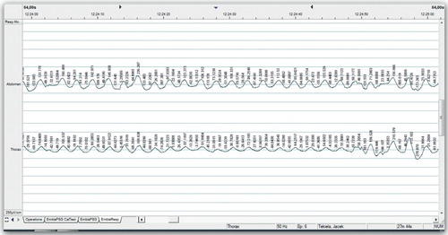 Figure 1. Examples of records of the chest respiratory movements while sitting on the first chair (with adjustable seat and backrest, with no possibility to adjust seat angle relative to the ground surface. The seat and back were connected, which implies that the backrest could not be adjusted to the length of the upper part of the body. The backrest was able to set at an angle in the range of 95°–100°).