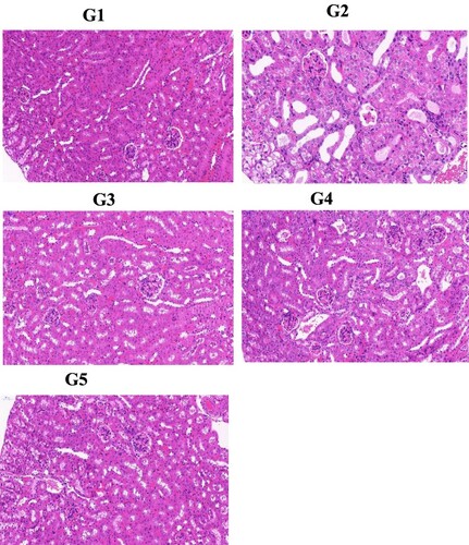 Figure 5. Effect of genistein on renal#histopathology features (magniﬁcation at 300×). G1: normal group, G2: Model control group, G3: positive control group, G4: low dose genistein treated group, G5: High dose genistein treated group.