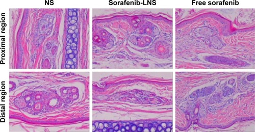 Figure 10 Photomicrographs of pathological sections of rabbit ear-rim vein after different treatments.Notes: Two parts of the ear vein were obtained for histopathological examination, including the region 1 cm (proximal region) and 2 cm (distal region) from the pinprick. Magnification 100×.Abbreviations: NS, normal saline; sorafenib-LNS, sorafenib-loaded lipid-based nanosuspensions.