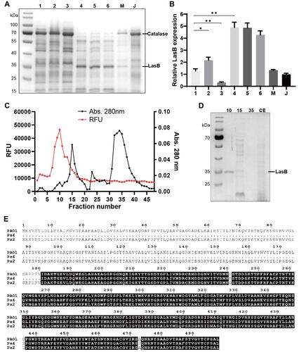 Figure 4 Proteomic analysis of exoproducts and purification of the virulent protease LasB (A) SDS-PAGE of exoproducts from 8 P. aeruginosa strains. (B) Relative LasB expression of 8 P. aeruginosa strains. *P < 0.05; **P < 0.005; (C) elution profile of LasB protease on DEAE 52 cellulose column. (D) Verification of LasB purity by SDS-PAGE. 10, purified LasB (Fraction 10); 15, impurities (Fraction 15); 35, impurities (Fraction 35); CE, crude enzyme solution. (E) Amino acid sequence alignment of Las B from Pa 4, Pa 2 and PAO1.